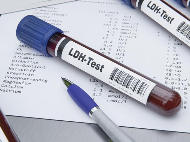 LDH en un análisis de sangre.